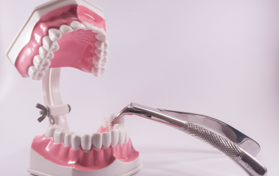 Extractions1 Tooth Extractions