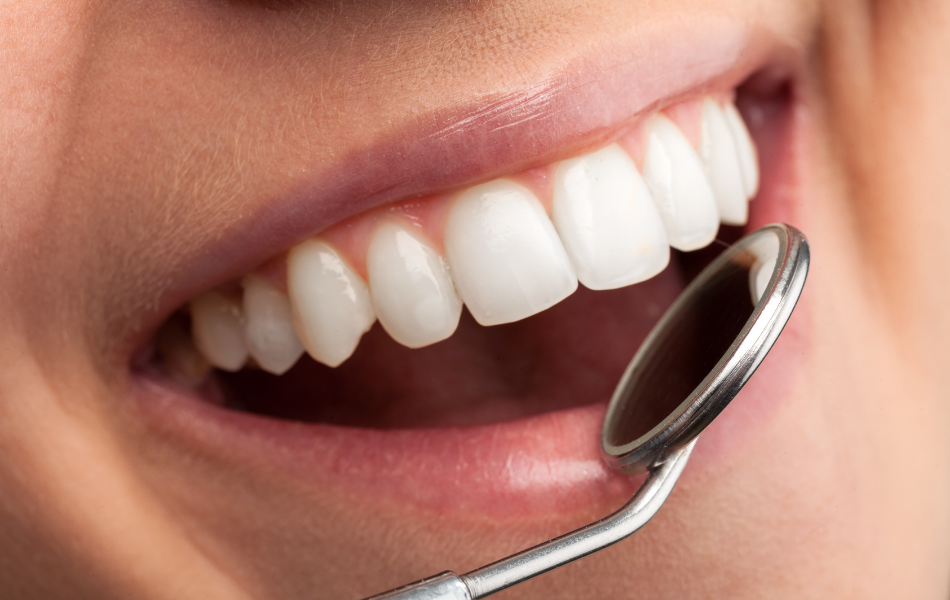 Dental Extractions Hornsby