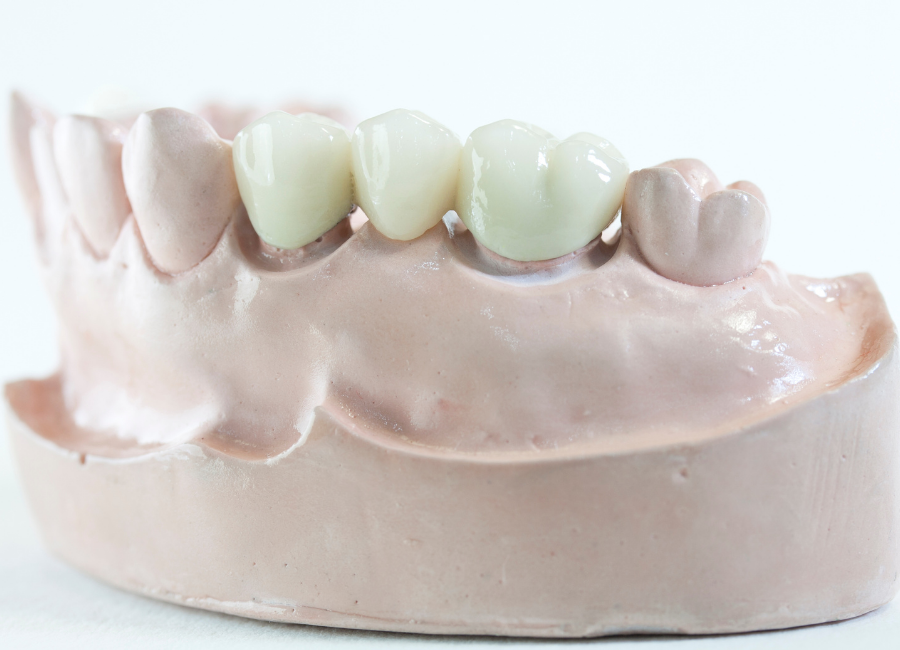 Bridges and crowns in Hornsby