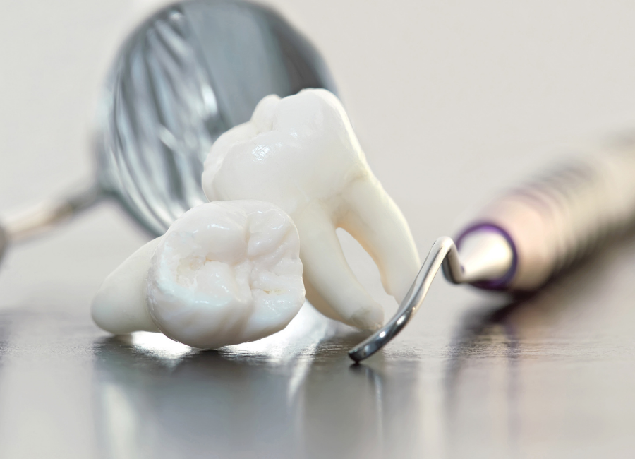 Untitled design (73) Wisdom Teeth Removal Hornsby